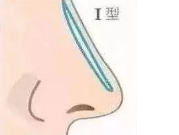 ~μw