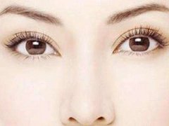 呼和浩特市埋線雙眼皮能維持多久?