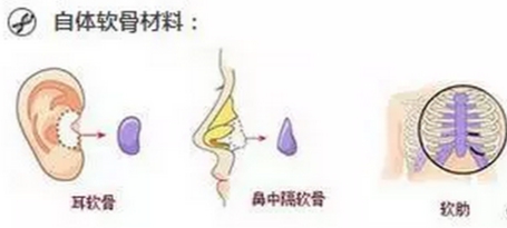 ͺt(y)Ժw¡ʲô(yu)(sh)