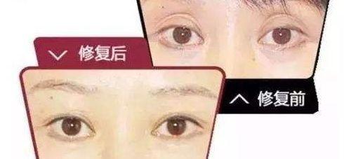 ͺpƤޏ(f)ҪעЩʲô