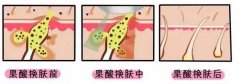 ͺQwҪעЩʲô?