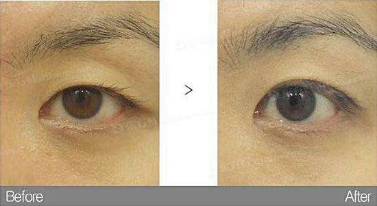 ͺpƤ_(ki)۽ǶX(qin)