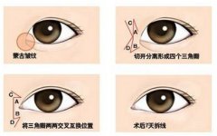 為什么眼睛看著不大不夠亮呢?