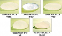 假體隆胸如何預(yù)防包膜攣縮?