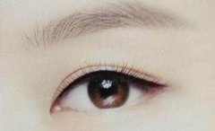 呼和浩特整形做美瞳線后要注意什么?