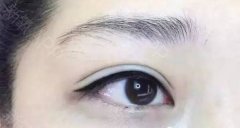 呼市整形美瞳線和眼線的區(qū)別有哪些?