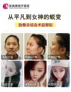 什么是鼻綜合呢?一個(gè)好看的鼻子塑造80%的美~