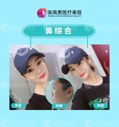 一個(gè)漂亮的鼻子撐起了80%的顏值?