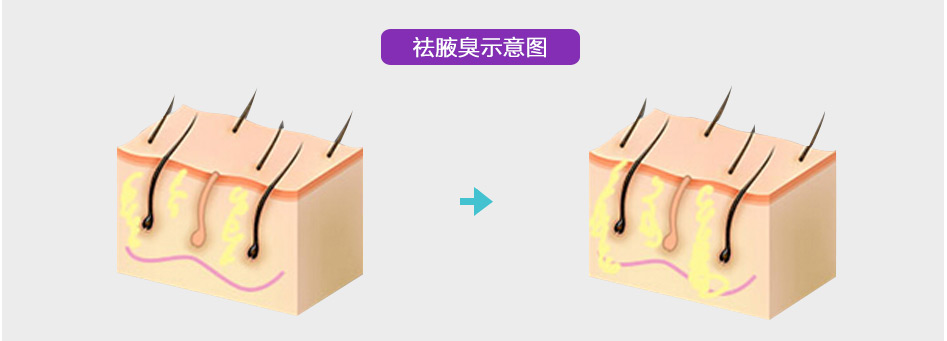 ͺt(y)Ժ