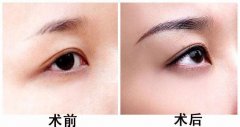 yüΣU(xin)