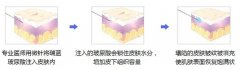 玻尿酸除皺有沒有副作用呢?