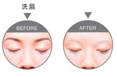 呼市激光洗眉痛不痛?