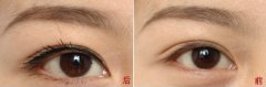 呼市美瞳線好還是紋眼線好?