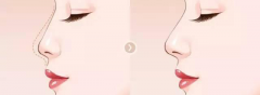 ͺg(sh)^ô