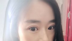 雙眼皮、隆鼻等手術(shù)一定會留疤嗎?呼市整形醫(yī)院